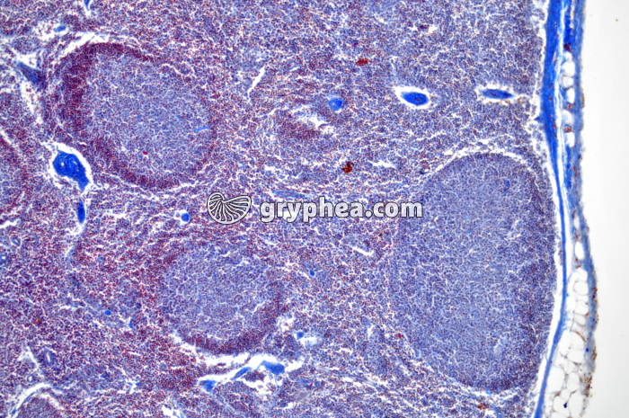 Ganglion lymphatique x25 - gryphea.com